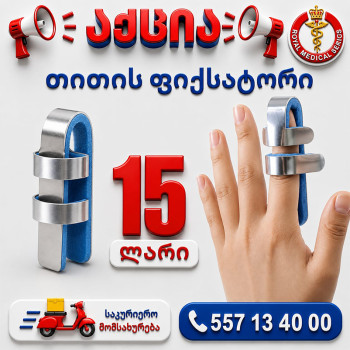 თითის ფიქსატორი