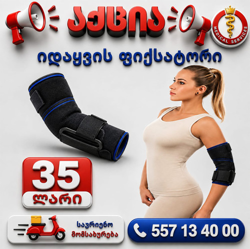 იდაყვის ფიქსატორი